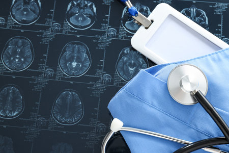 MRI scans or magnetic resonance imaging with a stethoscope and a blank card.の写真素材