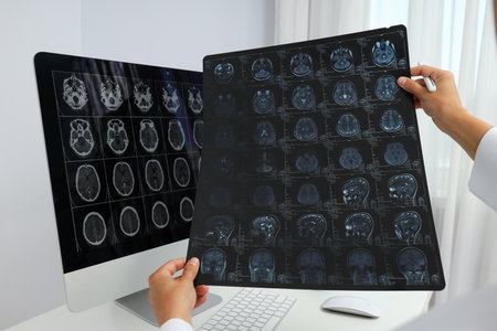 MRI images of a human head in the hands of a doctor