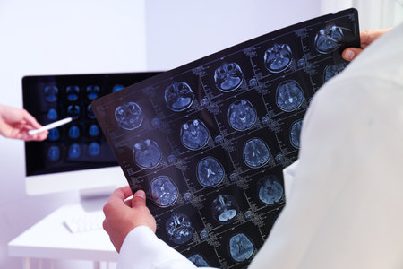 MRI images of a human head in the hands of a doctor