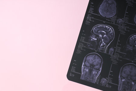 MRI or magnetic resonance imaging of the head and brain. Place for textの写真素材
