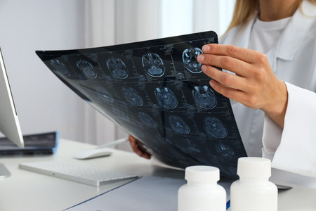 A young female doctor is looking at an MRI image of a human head