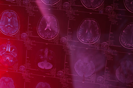 MRI or magnetic resonance imaging of the head and brain in red light. close-up