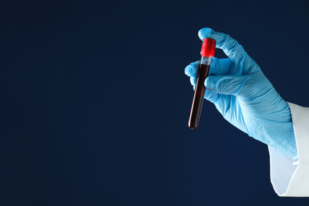 Test tube with donor blood in gloved hand on blue background, space for text
