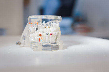 Closeup of plastic jaws model on table in dentist officeの写真素材