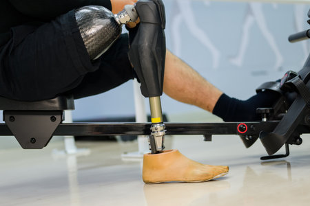 Disabled sporty man exercising with prosthetic leg at gymの写真素材