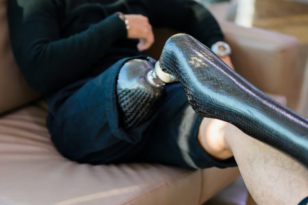Young man with prosthetic leg sitting on health care centerの写真素材