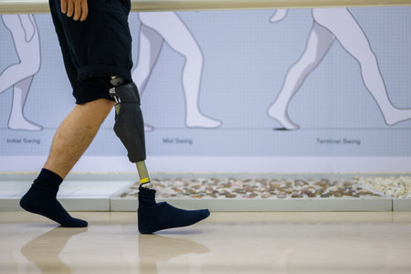 Athlete man with prosthetic leg walking at health care centerの写真素材