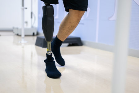 Disabled athlete patient with physical disability doing exerciseの写真素材