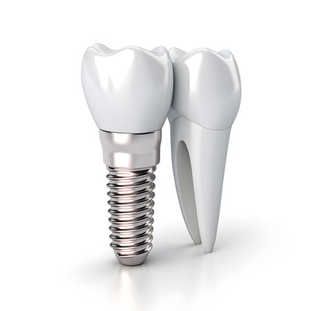 The concept of dental implant surgery. Image of implants on a white backgroundの素材