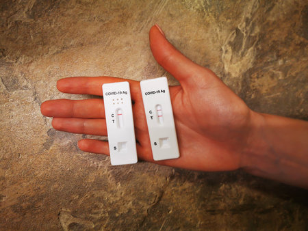 Girl holds two different Covid-19 laboratory tests in her hands - positive and negative