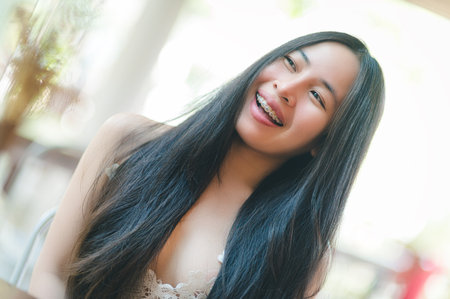 A cheerful young woman with long straight hair and braces smiles warmly in a bright outdoor setting, embodying joy and natural beauty.の写真素材