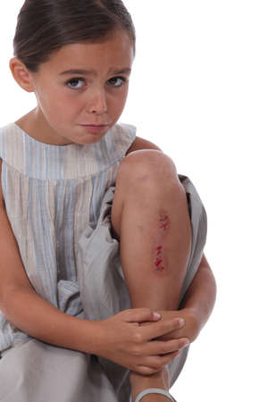 a little girl with a  wounded legの写真素材