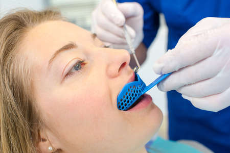 Dentist using a mouth guard on a a womanの写真素材