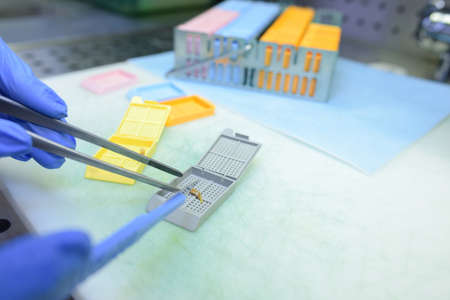 Small object being handled with tweezersの写真素材