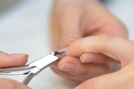 Tweezers being used on a woman's fingernailの写真素材