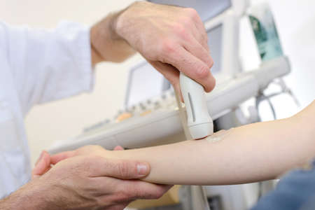 ultrasonography on the armの写真素材