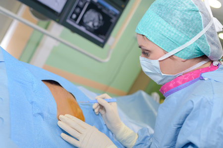 removing a tumor