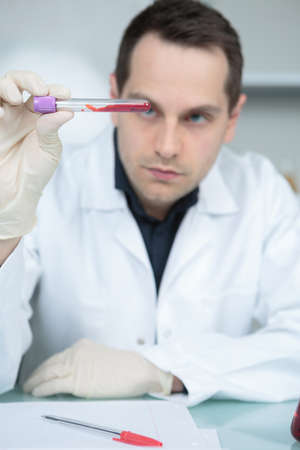 doctor scientist with blood exampleの写真素材