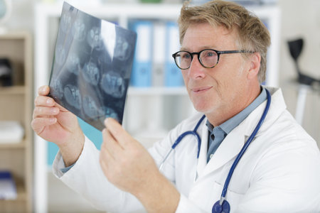 senior man medical doctor looking at x-rays in a hospitalの写真素材