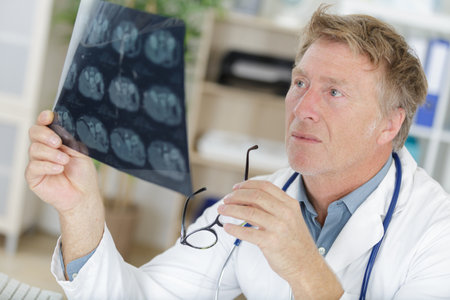 portrait of senior doctor examining x-rayの写真素材