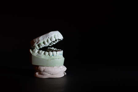 Gypsum Dental model of human teeth on black background.の写真素材