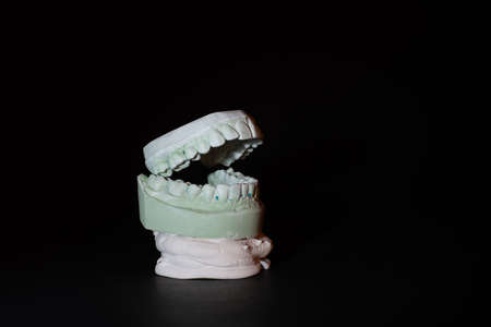 Gypsum Dental model of human teeth on black background.の写真素材