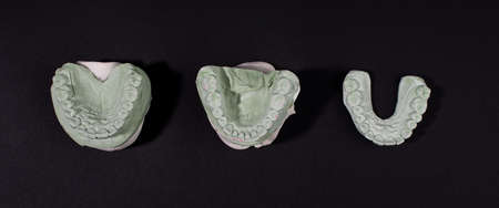 Banner with gypsum dental models of human teeth.の写真素材