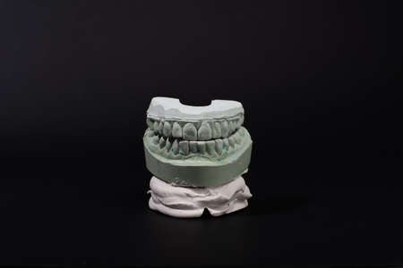 Gypsum Dental model of human teeth on black background.の写真素材