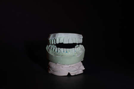 Gypsum Dental model of human teeth on black background.の写真素材