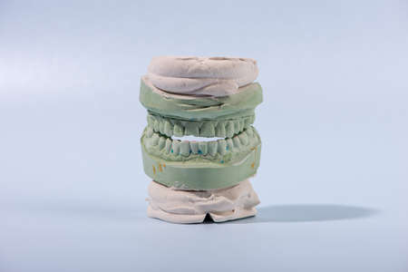 Gypsum Dental model of human teeth on blue background.の写真素材