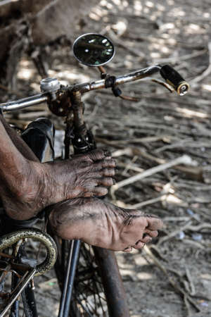 Wrinkled and dirty foot Of older people from working hard の写真素材
