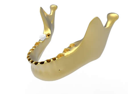 3d illustration of mandible with tooth. white background isolated. icon for game web.の写真素材
