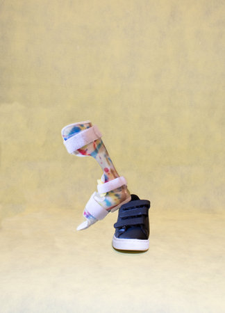 foot orthotics for paralysis problems and rehabilitation for Dafo orthotics on a blue sports shoe both with fastener on yellow background and copy space for child disability conceptの写真素材