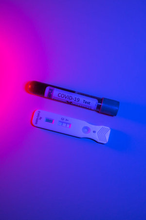 blood test and rapid antigen test with positive result to control the mobility of the society