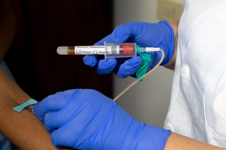 Drawing blood to perform a blood test. The blood tube indicates positive for the coronavirus. The...