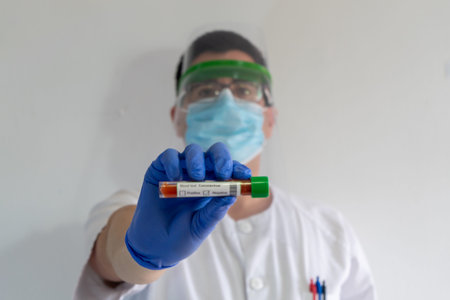 Doctor / nurse with a face shield. He is showing a coronavirus test tube. The blood tube indicates...