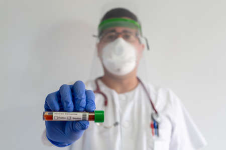 Doctor with face shield shows a tube blood. The test tube indicates positive. He wears a white uniform, wears a mask, gloves and glasses.の写真素材