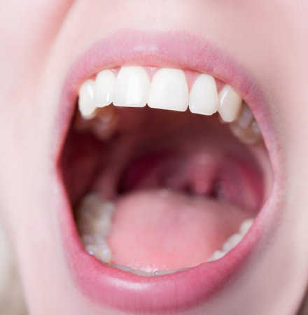 white women smile