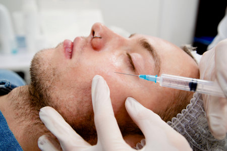 Dermatologists making injections to mans face to remove scars and wrinkles and make it smooth and youngの写真素材