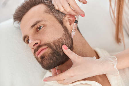 Close up makes mesotherapy injections to beard man. Treatment of male by a beautician for hair growthの写真素材