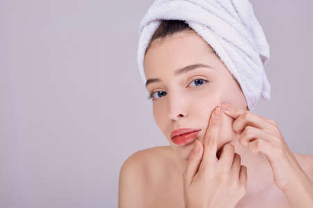 Beautiful girl after a shower, half-naked, in a white towel on her head crushes acne on her cheek. Imperfections in the skin. The concept of beauty and care. Inflammation on the skin.の写真素材