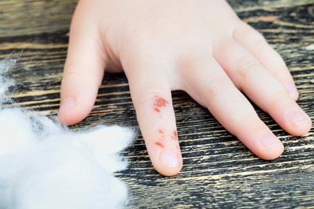a small injury on the finger of the hand, the hand with an injury that is healing or almost healed