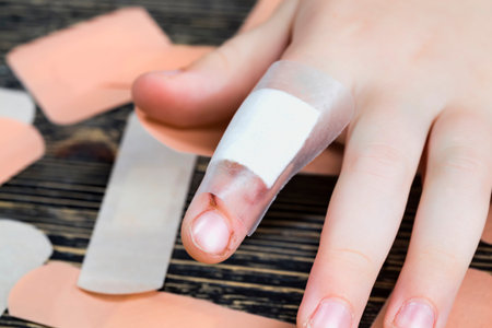 one damaged finger on the hand, the hand with the damage that is being treated through a medical band-aid for the woundの写真素材