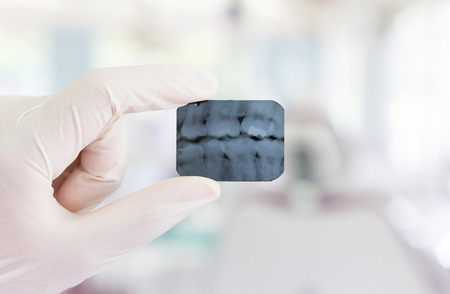 Doctor holding and looking at dental x-rayの写真素材