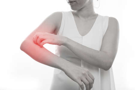 woman scratching arm on isolated white background, concept of health care lifestyle. view from front body.の写真素材