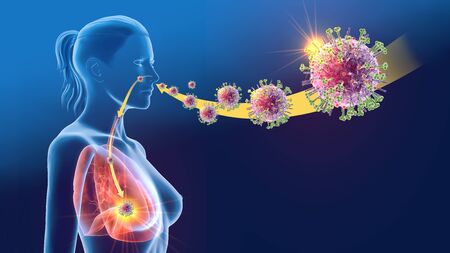 3D illustration showing influenza viruses infecting a womanの写真素材