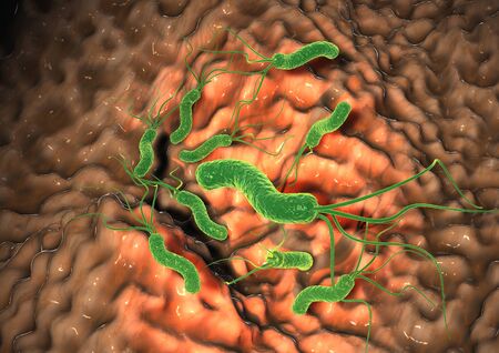 3D Illustration showing helicobacter pylori bacteria damaging mucus layer, gastritisの写真素材