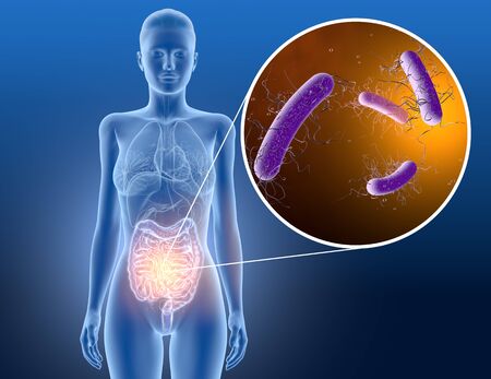 3D illustration showing clostridium difficile bacteria in intestineの写真素材
