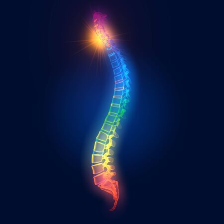 Medically 3D illustration showing painful cervical spineの写真素材