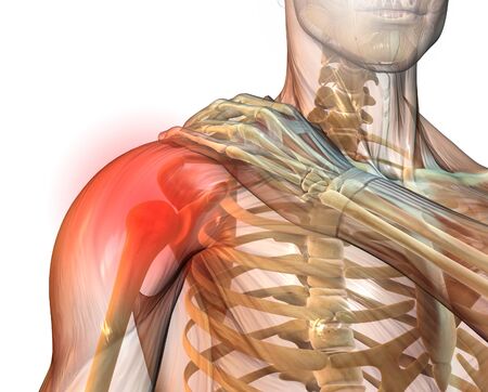 3D illustration showing painful shoulder joint of a manの写真素材